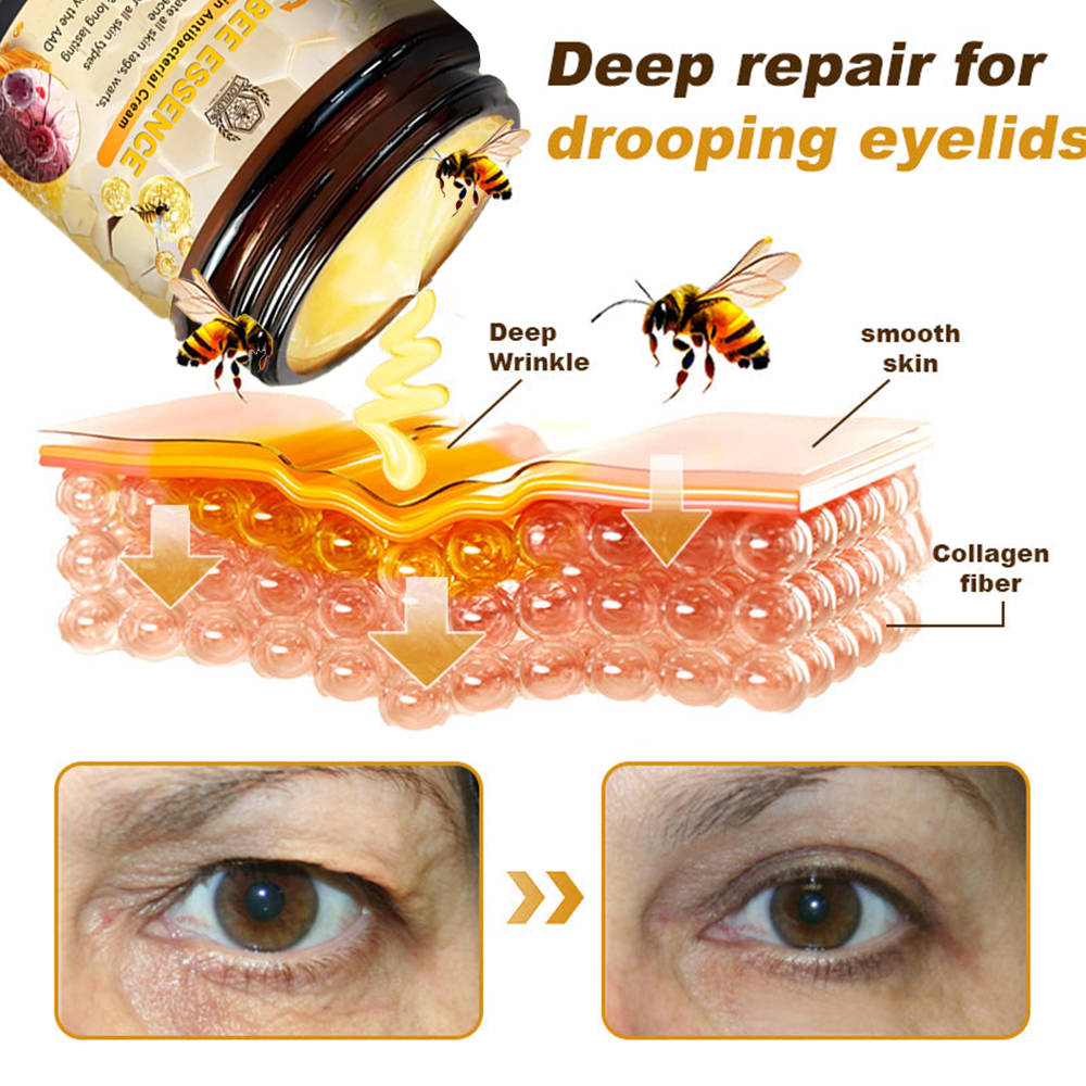 LOVILDS™ Bee Essence Skin Antibacterial Cream—used to treat a variety of skin diseases (AAD recommended)`