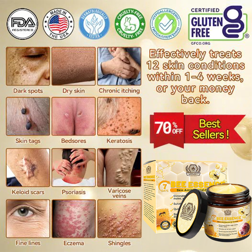 LOVILDS™ Bee Essence Skin Antibacterial Cream—used to treat a variety of skin diseases (AAD recommended)`
