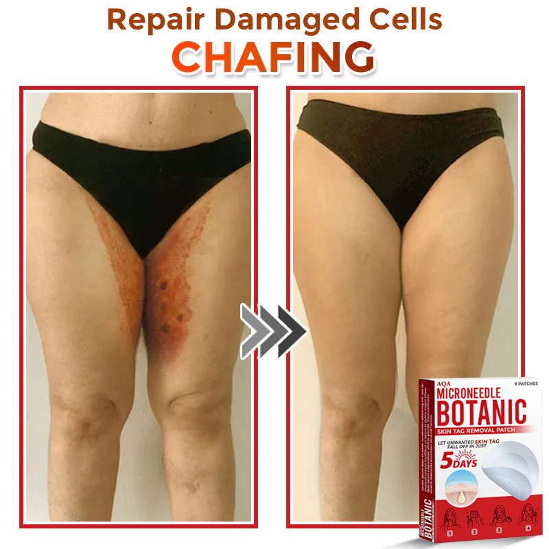 AQA® Botanical MicroNeedle Skin Tag Removal Patches – Safe & USA-Made