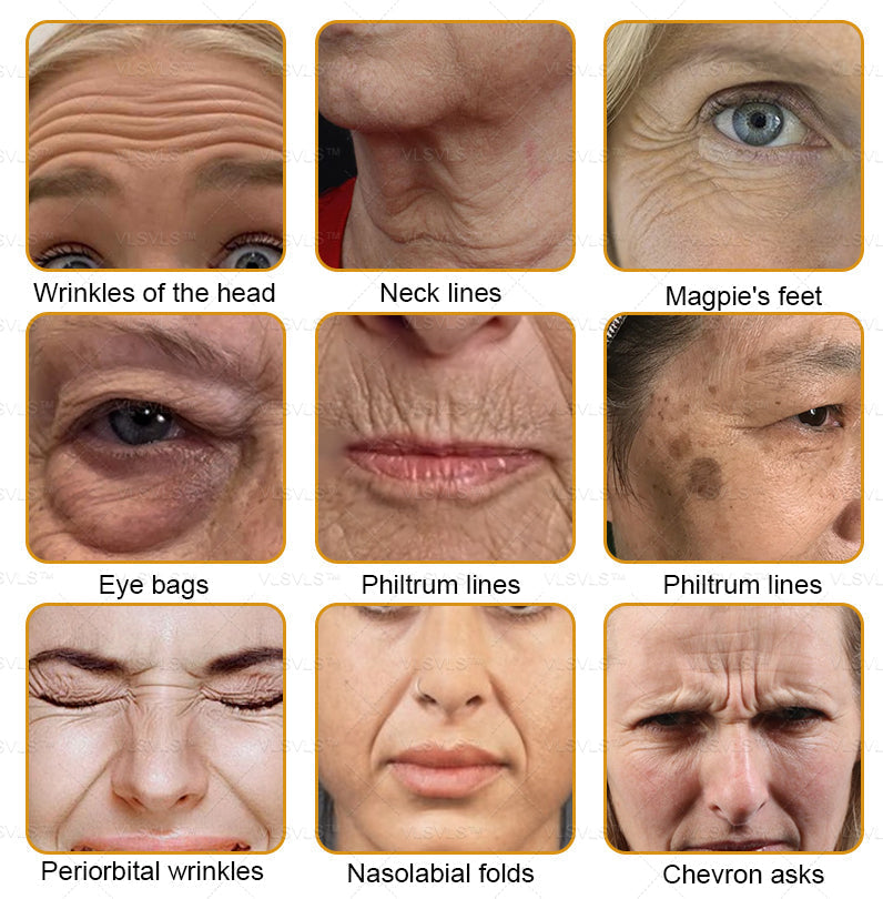 LOVILDS™ Bee Essence Skin Antibacterial Cream—used to treat a variety of skin diseases (AAD recommended)`