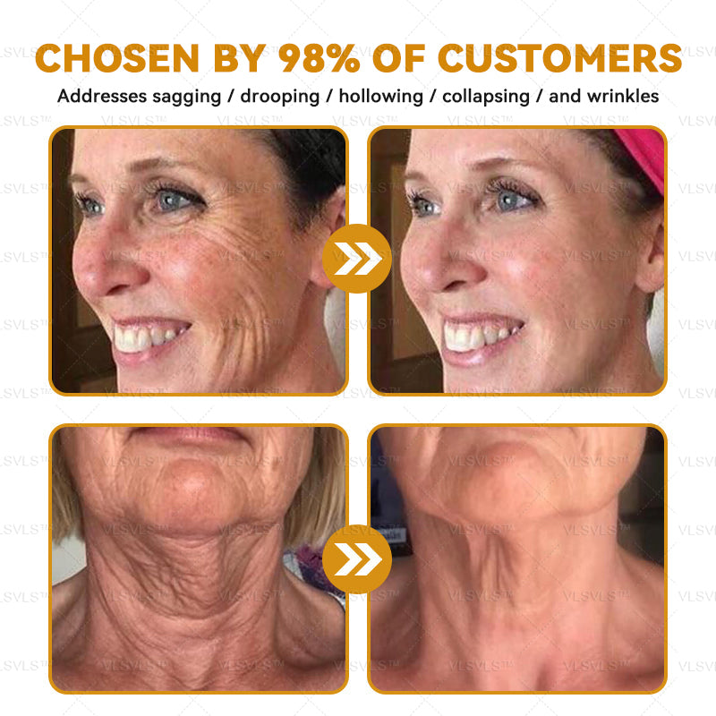 LOVILDS™ Bee Essence Skin Antibacterial Cream—used to treat a variety of skin diseases (AAD recommended)`