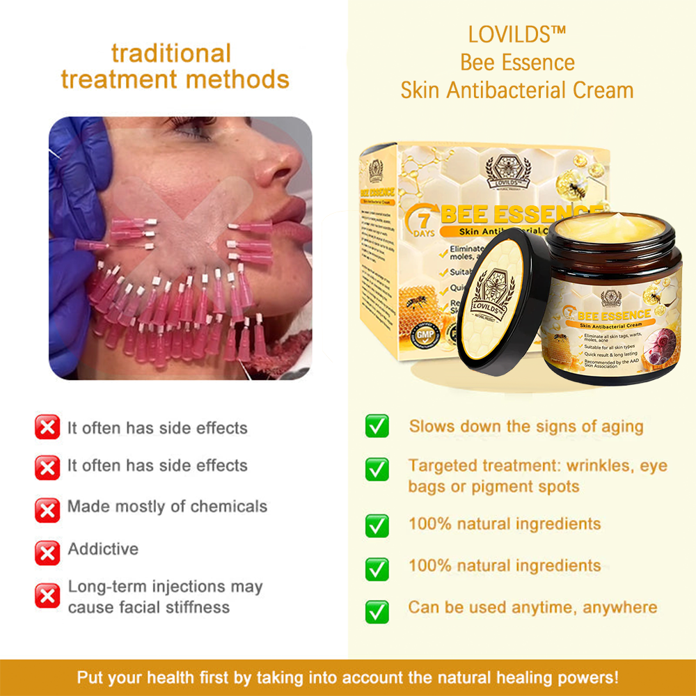 LOVILDS™ Bee Essence Skin Antibacterial Cream—used to treat a variety of skin diseases (AAD recommended)`