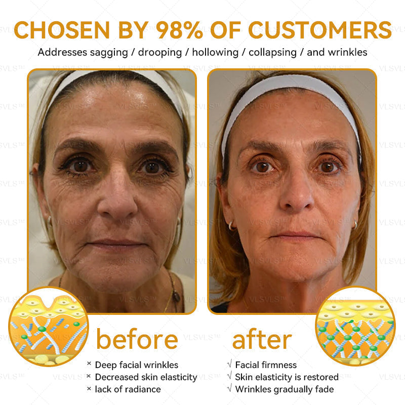 LOVILDS™ Bee Essence Skin Antibacterial Cream—used to treat a variety of skin diseases (AAD recommended)`