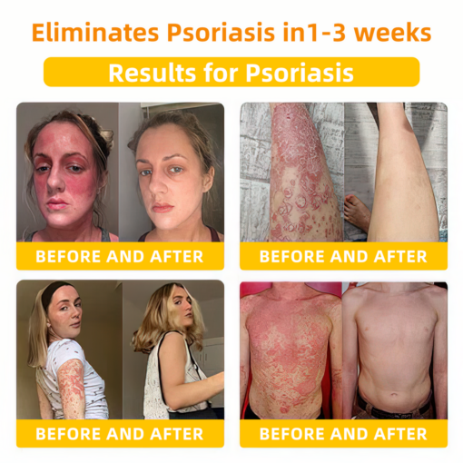 LOVILDS™ Bee Toxin Skin Repair Cream(AAD Recommended👨‍⚕️)`