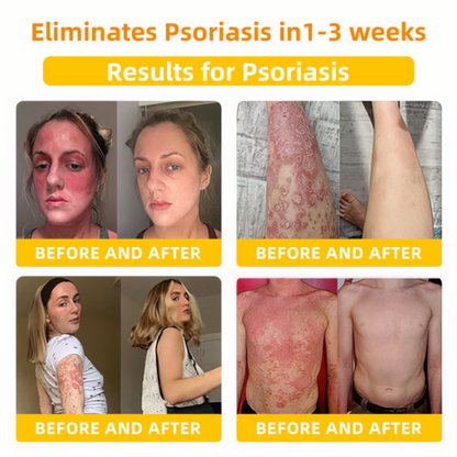 LOVILDS™ Bee Toxin Skin Repair Cream(AAD Recommended👨‍⚕️)`