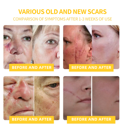 LOVILDS™ Bee Toxin Skin Repair Cream(AAD Recommended👨‍⚕️)`