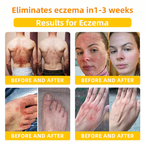 LOVILDS™ Bee Toxin Skin Repair Cream(AAD Recommended👨‍⚕️)`
