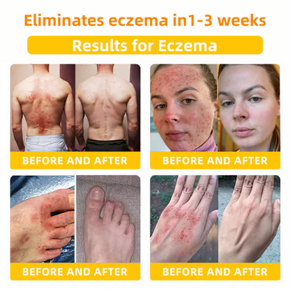 LOVILDS™ Bee Toxin Skin Repair Cream(AAD Recommended👨‍⚕️)`